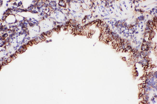 ICAM-1 / CD54 Antibody - ICAM1 / CD54 antibody. IHC(P): Mouse Lung Tissue.