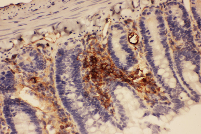 ICAM-1 / CD54 Antibody - ICAM1 / CD54 antibody. IHC(P): Rat Intestine Tissue.
