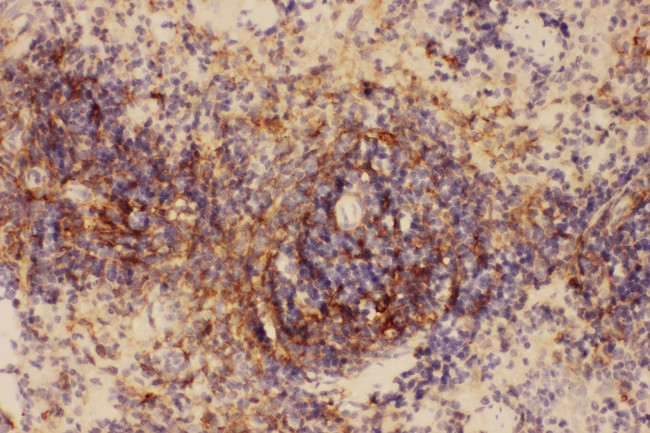 ICAM-1 / CD54 Antibody - ICAM1 / CD54 antibody. IHC(P): Rat Spleen Tissue.