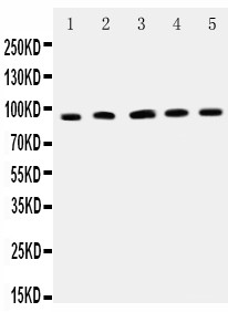 ICAM-1 / CD54 Antibody - WB of ICAM1 / CD54 antibody. All lanes: Anti-ICAM1 at 0.5ug/ml. Lane 1: Rat Thymus Tissue Lysate at 40ug. Lane 2: Rat Spleen Tissue Lysate at 40ug. Lane 3: PC12 Whole Cell Lysate at 40ug. Lane 4: NRK Whole Cell Lysate at 40ug. Lane 5: RH35 Whole Cell Lysate at 40ug. Predicted bind size: 58KD. Observed bind size: 90KD.