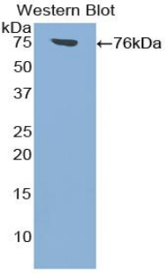 ICAM-1 / CD54 Antibody - Western blot of recombinant ICAM1 / CD54.  This image was taken for the unconjugated form of this product. Other forms have not been tested.