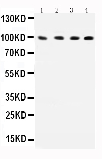 ICAM-1 / CD54 Antibody - Anti-ICAM1 Picoband antibody, Western blotting All lanes: Anti-ICAM1 at 0.5ug/ml Lane 1: HEPG2 Whole Cell Lysate at 40ugLane 2: K562 Whole Cell Lysate at 40ugLane 3: A549 Whole Cell Lysate at 40ugLane 4: HT1080 Whole Cell Lysate at 40ug Predicted bind size: 58KD Observed bind size: 100KD