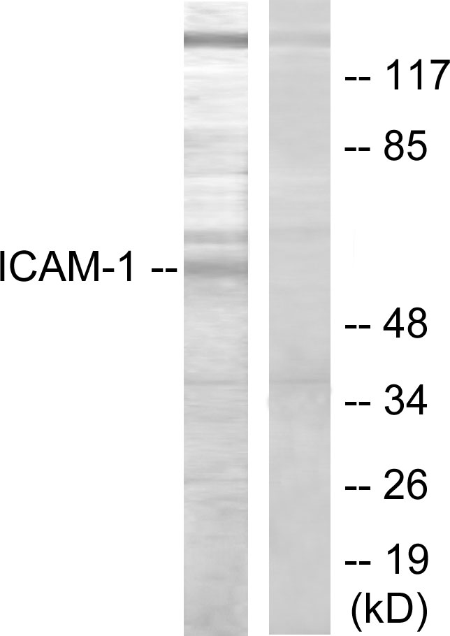 ICAM-1 / CD54 Antibody - Western blot analysis of lysates from HepG2 cells, using ICAM-1 Antibody. The lane on the right is blocked with the synthesized peptide.