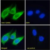 ICAM-1 / CD54 Antibody - ICAM-1 / CD54 antibody immunofluorescence analysis of paraformaldehyde fixed NIH3T3 cells, permeabilized with 0.15% Triton. Primary incubation 1hr (5ug/ml) followed by Alexa Fluor 488 secondary antibody (2ug/ml), showing cytoplasmic/membrane staining. The nuclear stain is DAPI (blue). Negative control: Unimmunized goat IgG (10ug/ml) followed by Alexa Fluor 488 secondary antibody (2ug/ml).