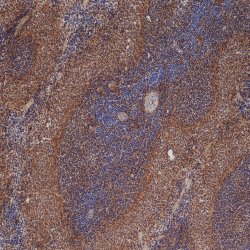 ICAM-1 / CD54 Antibody - Staining of frozen rat spleen with Mouse anti-Rat CD54 (MOUSE ANTI RAT CD54).  This image was taken for the unmodified form of this product. Other forms have not been tested.