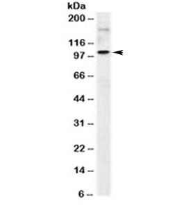 ICAM-1 / CD54 Antibody - Western blot testing of human Raji cell lysate with ICAM-1 antibody (clone 1H4). Predicted molecular weight: ~58/75-115kDa (unmodified/glycosylated).