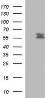 ICAM-1 / CD54 Antibody - HEK293T cells were transfected with the pCMV6-ENTRY control (Left lane) or pCMV6-ENTRY ICAM1 (Right lane) cDNA for 48 hrs and lysed. Equivalent amounts of cell lysates (5 ug per lane) were separated by SDS-PAGE and immunoblotted with anti-ICAM1.