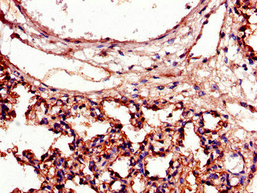 ICAM-1 / CD54 Antibody - Immunohistochemistry of paraffin-embedded human lung tissue using ICAM1 Antibody at dilution of 1:100