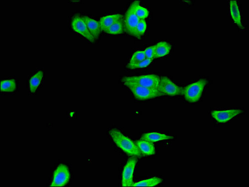 ICAM-1 / CD54 Antibody - Immunofluorescent analysis of HepG2 cells using ICAM1 Antibody at a dilution of 1:100 and Alexa Fluor 488-congugated AffiniPure Goat Anti-Rabbit IgG(H+L)