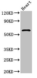 ICAM-1 / CD54 Antibody - Western Blot Positive WB detected in: Rat heart tissue All lanes: ICAM1 antibody at 2.4µg/ml Secondary Goat polyclonal to rabbit IgG at 1/50000 dilution Predicted band size: 58 kDa Observed band size: 58 kDa