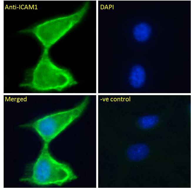 ICAM-1 / CD54 Antibody - ICAM-1 / CD54 antibody immunofluorescence analysis of paraformaldehyde fixed NIH3T3 cells, permeabilized with 0.15% Triton. Primary incubation 1hr (5ug/ml) followed by Alexa Fluor 488 secondary antibody (2ug/ml), showing membrane staining. The nuclear stain is DAPI (blue). Negative control: Unimmunized goat IgG (10ug/ml) followed by Alexa Fluor 488 secondary antibody (2ug/ml).