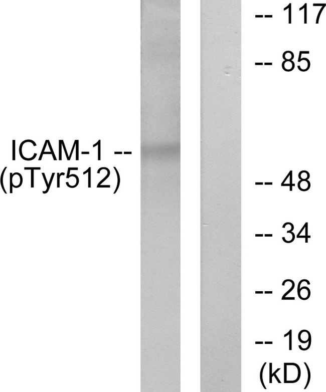 ICAM-1 / CD54 Antibody - Western blot analysis of lysates from HeLa cells treated with TNF-alpha 20ng/ml 5', using ICAM-1 (Phospho-Tyr512) Antibody. The lane on the right is blocked with the phospho peptide.