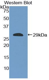 ICAM2 / CD102 Antibody - Western blot of recombinant ICAM2 / CD102 / ICAM-2.  This image was taken for the unconjugated form of this product. Other forms have not been tested.