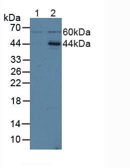 ICAM2 / CD102 Antibody - Western Blot; Sample: Lane1: Human Jurkat Cells; Lane2: Human Hela Cells.