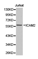 ICAM2 / CD102 Antibody - Western blot of extracts of Jurkat cell lines, using ICAM2 antibody.
