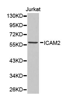 ICAM2 / CD102 Antibody - Western blot analysis of extracts of Jurkat cell lines.