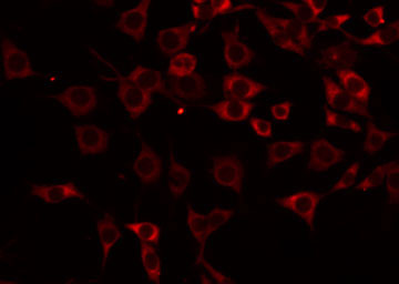 ICAM2 / CD102 Antibody - Staining NIH-3T3 cells by IF/ICC. The samples were fixed with PFA and permeabilized in 0.1% Triton X-100, then blocked in 10% serum for 45 min at 25°C. The primary antibody was diluted at 1:200 and incubated with the sample for 1 hour at 37°C. An Alexa Fluor 594 conjugated goat anti-rabbit IgG (H+L) Ab, diluted at 1/600, was used as the secondary antibody.