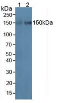 ICAM3 / CD50 Antibody - Western Blot; Sample: Lane1: Human HL60 Cells; Lane2: Human U937 Cells.
