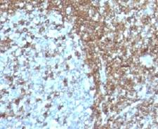 ICAM3 / CD50 Antibody - IHC analysis of FFPE human tonsil with CD50 antibody (clone 186-2G9).