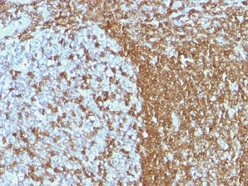 ICAM3 / CD50 Antibody - Formalin-fixed, paraffin-embedded human tonsil stained with ICAM3 antibody (ICAM3/1019).  This image was taken for the unmodified form of this product. Other forms have not been tested.