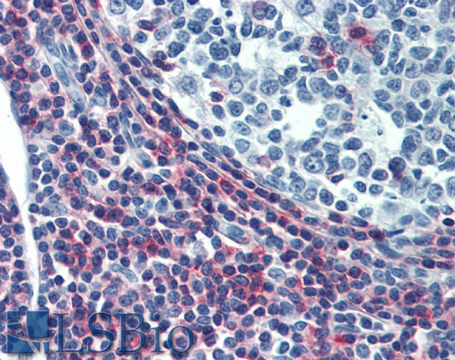 ICAM3 / CD50 Antibody - Immunohistochemistry staining of human tonsil (paraffin sections) using anti-CD50 (MEM-04).  Commercially tested by LifeSpan BioSciences.