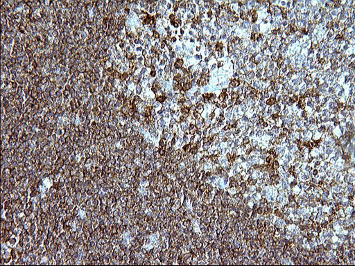 ICAM3 / CD50 Antibody - IHC of paraffin-embedded Human lymph node tissue using anti-ICAM3 mouse monoclonal antibody. (Heat-induced epitope retrieval by 1 mM EDTA in 10mM Tris, pH8.5, 120°C for 3min).