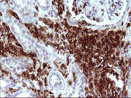 ICAM3 / CD50 Antibody - IHC of paraffin-embedded Human Kidney tissue using anti-ICAM3 mouse monoclonal antibody. (Heat-induced epitope retrieval by 10mM citric buffer, pH6.0, 120°C for 3min).