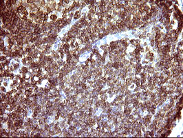 ICAM3 / CD50 Antibody - IHC of paraffin-embedded Human lymph node tissue using anti-ICAM3 mouse monoclonal antibody. (Heat-induced epitope retrieval by 10mM citric buffer, pH6.0, 120°C for 3min).