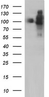 ICAM3 / CD50 Antibody - HEK293T cells were transfected with the pCMV6-ENTRY control (Left lane) or pCMV6-ENTRY ICAM3 (Right lane) cDNA for 48 hrs and lysed. Equivalent amounts of cell lysates (5 ug per lane) were separated by SDS-PAGE and immunoblotted with anti-ICAM3.