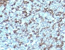 ICAM3 / CD50 Antibody - Formalin-fixed, paraffin-embedded human tonsil stained with anti-ICAM-3 antibody (SPM505).  This image was taken for the unmodified form of this product. Other forms have not been tested.