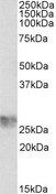 ICAM4 / CD242 Antibody - ICAM4 antibody (1 ug/ml) staining of Human Umbilical Cord lysate (35 ug protein in RIPA buffer). Primary incubation was 1 hour. Detected by chemiluminescence.