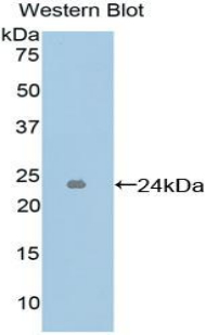 ICAM4 / CD242 Antibody - Western blot of recombinant ICAM4 / CD242.  This image was taken for the unconjugated form of this product. Other forms have not been tested.