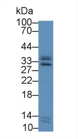 ICAM4 / CD242 Antibody - Western Blot; Sample: Human Liver lysate; Primary Ab: 2µg/mL Rabbit Anti-Human ICAM4 Antibody Second Ab: 0.2µg/mL HRP-Linked Caprine Anti-Rabbit IgG Polyclonal Antibody
