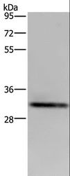 ICAM4 / CD242 Antibody - Western blot analysis of OP9 cell, using ICAM4 Polyclonal Antibody at dilution of 1:500.