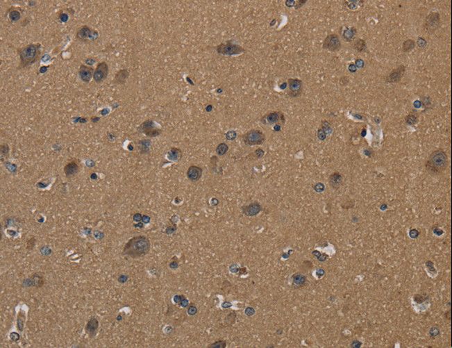 ICAM4 / CD242 Antibody - Immunohistochemistry of paraffin-embedded Human brain using ICAM4 Polyclonal Antibody at dilution of 1:50.