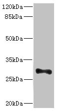 ICAM4 / CD242 Antibody - Western blot All Lanes: ICAM4 antibody at 4.98ug/ml+ Mouse brain tissue Goat polyclonal to rabbit at 1/10000 dilution Predicted band size: 30,26 kDa Observed band size: 29 kDa