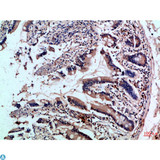 ICAM4 / CD242 Antibody - Immunohistochemical analysis of paraffin-embedded human-colon, antibody was diluted at 1:100.
