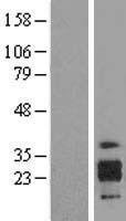 ICAM4 / CD242 Protein - Western validation with an anti-DDK antibody * L: Control HEK293 lysate R: Over-expression lysate