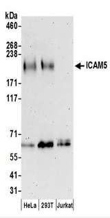 ICAM5 / ICAM-5 Antibody - Detection of Human ICAM5 by Western Blot. Samples: Whole cell lysate (50 ug) prepared using RIPA buffer from HeLa, 293T, and Jurkat cells. Antibodies: Affinity purified rabbit anti-ICAM5 antibody used for WB at 0.4 ug/ml. Detection: Chemiluminescence with an exposure time of 3 minutes.