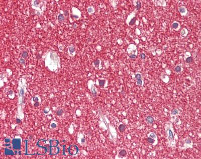 ICAM5 / ICAM-5 Antibody - Human Brain, Cortex: Formalin-Fixed, Paraffin-Embedded (FFPE), at a concentration of 5 ug/ml. 