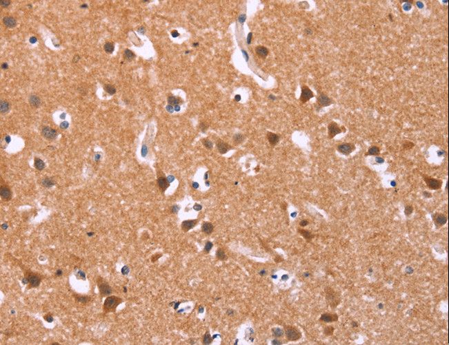 ICAM5 / ICAM-5 Antibody - Immunohistochemistry of paraffin-embedded Human brain using ICAM5 Polyclonal Antibody at dilution of 1:25.