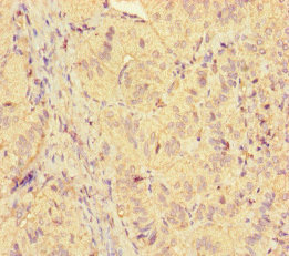 ICE1 Antibody - Immunohistochemistry of paraffin-embedded human adrenal gland tissue at dilution of 1:100