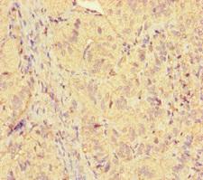 ICE1 Antibody - Immunohistochemistry of paraffin-embedded human adrenal gland tissue at dilution of 1:100