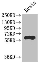 ICE1 Antibody - Western Blot Positive WB detected in:mouse brain tissue All Lanes: ICE1 antibody at 2.7ug/ml Secondary Goat polyclonal to rabbit IgG at 1/50000 dilution Predicted band size: 68 kDa Observed band size: 68 kDa