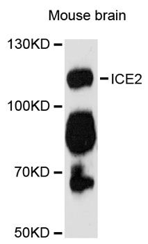ICE2 / NARG2 Antibody - Western blot analysis of extracts of mouse brain, using ICE2 antibody at 1:3000 dilution. The secondary antibody used was an HRP Goat Anti-Rabbit IgG (H+L) at 1:10000 dilution. Lysates were loaded 25ug per lane and 3% nonfat dry milk in TBST was used for blocking. An ECL Kit was used for detection and the exposure time was 90s.