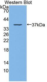 ICK Antibody - Western blot of ICK antibody.