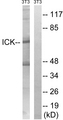 ICK Antibody - Western blot analysis of lysates from NIH/3T3 cells, treated with PBS 10uM 60', using ICK Antibody. The lane on the right is blocked with the synthesized peptide.