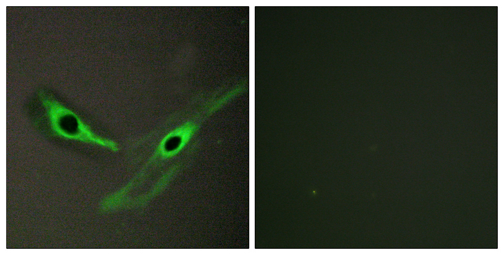 ICK Antibody - Immunofluorescence analysis of HeLa cells, using ICK Antibody. The picture on the right is blocked with the synthesized peptide.