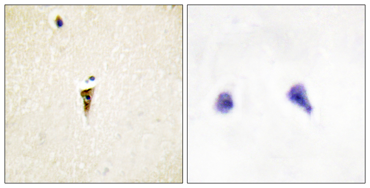 ICK Antibody - Immunohistochemistry analysis of paraffin-embedded human brain tissue, using ICK Antibody. The picture on the right is blocked with the synthesized peptide.