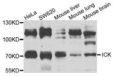 ICK Antibody - Western blot analysis of extracts of various cells.